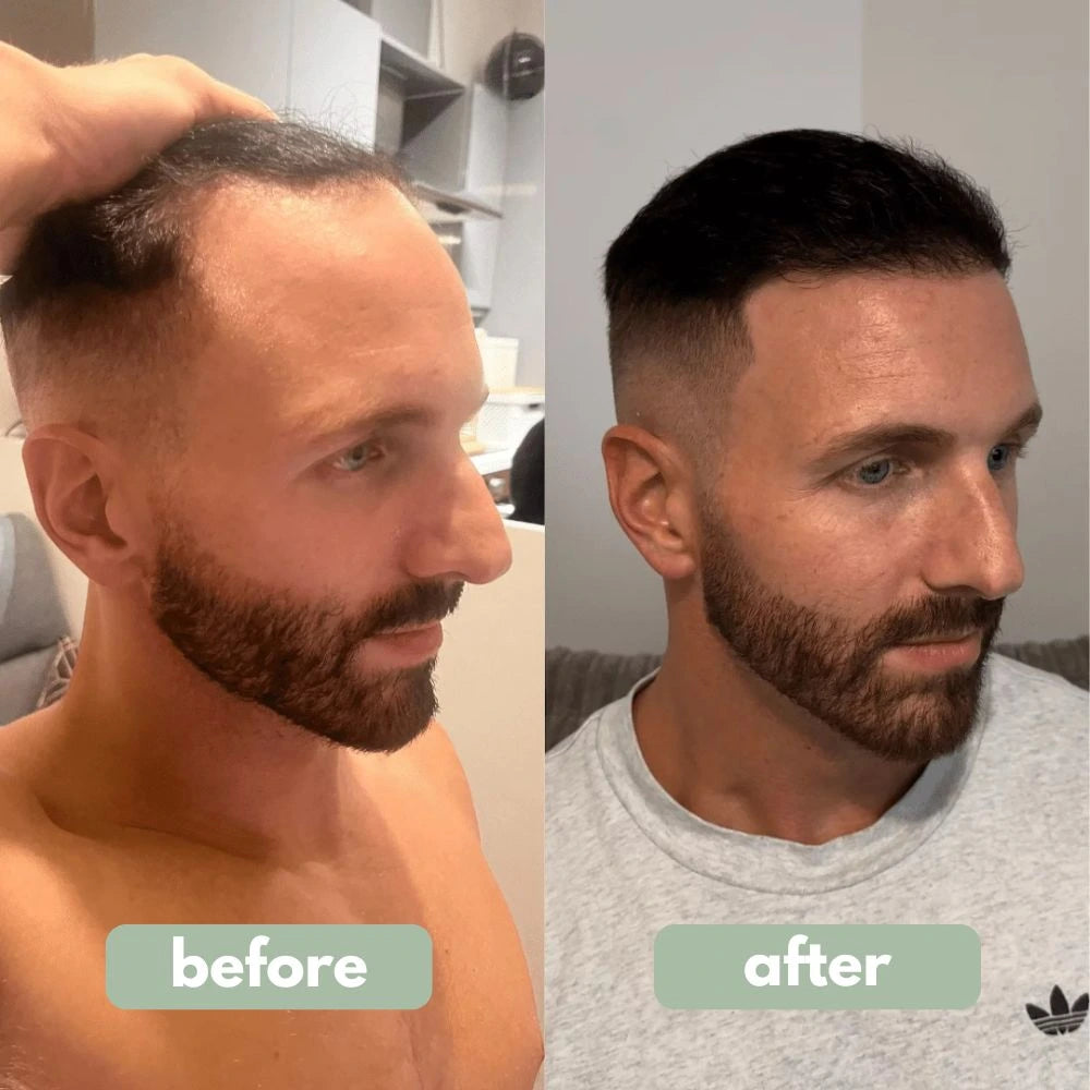 VitalRoots - Hair Growth Serum