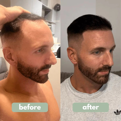 VitalRoots - Hair Growth Serum