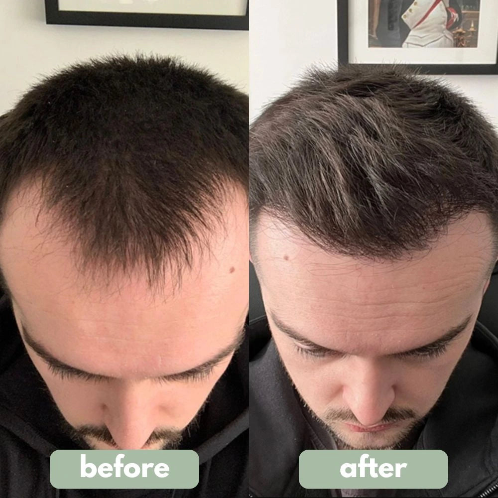 VitalRoots - Hair Growth Serum
